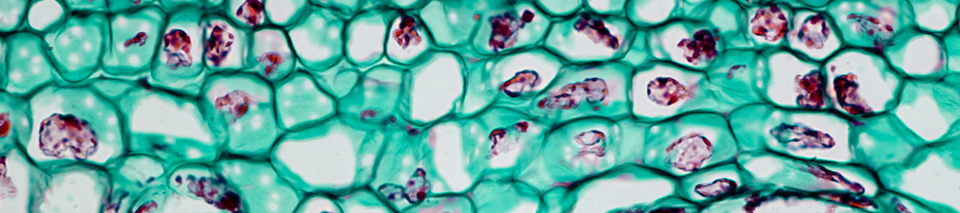bluegreen algae unter dem Mikroskop