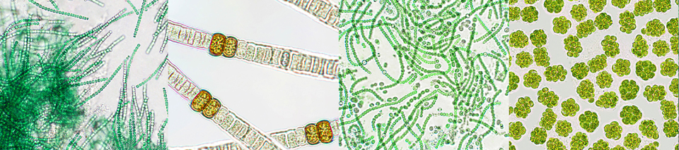 Cyanobakterien unter dem Milroskop