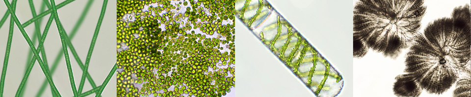 Cyanobakterien unter dem Mikroskop